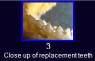 Property of OPEFE. Closeup of replacement teeth.